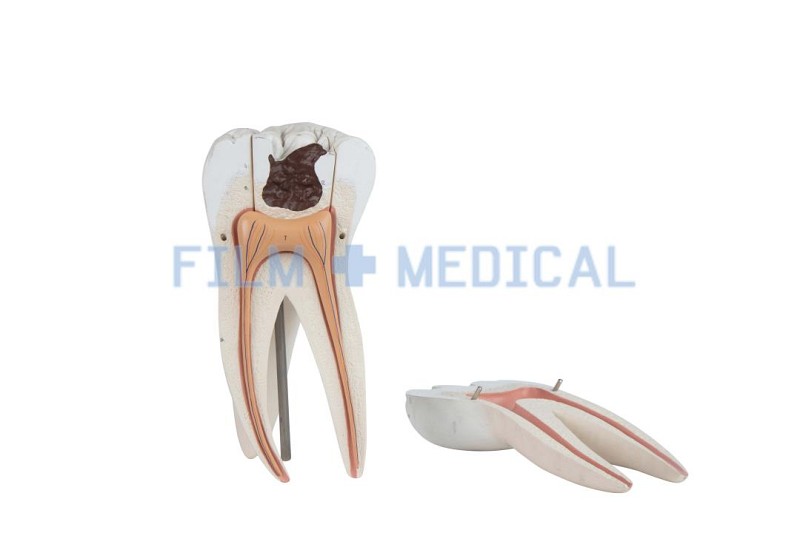 Tooth Model 
